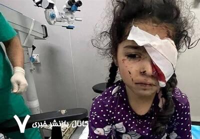 ۱۵۰۰ فلسطینی بینایی خود را در جنگ غزه از دست دادهاند ۱۵۰۰ فلسطینی بینایی خود را در جنگ غزه از دست دادهاند