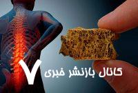 بیماری خاموشی که زنان را بیشتر از مردان تهدید می‌کند – خبرگزاری مهر | اخبار ایران و جهان