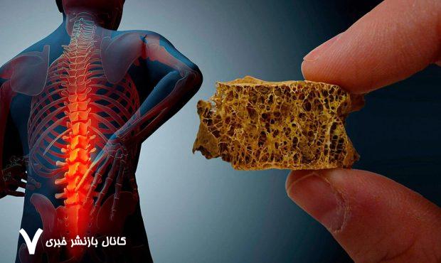 بیماری خاموشی که زنان را بیشتر از مردان تهدید می‌کند – خبرگزاری مهر | اخبار ایران و جهان