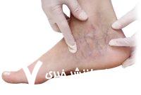 این علائم در پا را جدی بگیرید