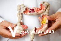۶ راز صبحگاهی برای بهبود یبوست