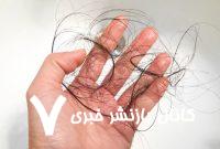 این کارهای ساده ریزش مو را کاهش می‌دهند