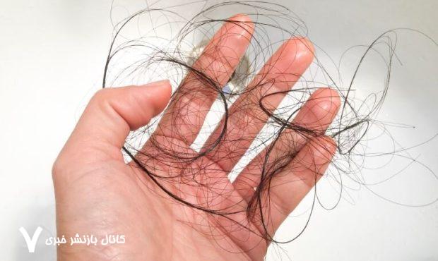 این کارهای ساده ریزش مو را کاهش می‌دهند