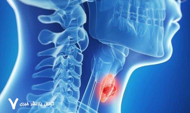 بهترین مواد غذایی برای نجات تیروئید