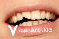 چرا دندان‌ها زود به زود پوسیده می‌شوند؟