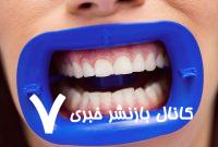آیا خدمات دندانپزشکی در ایران لوکس محسوب می‌شود؟