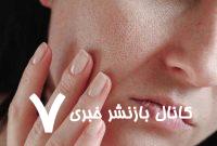 این میوه پوست شما را جوان نگه می‌دارد
