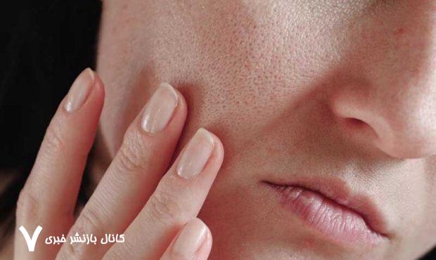 این میوه پوست شما را جوان نگه می‌دارد