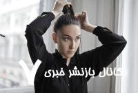 برخی مدل‌های محبوب مو می‌توانند باعث ریزش دائمی شوند