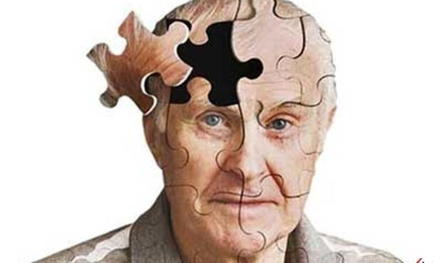 «زمان» خود میتواند عاملی حیاتی در پیشگیری از زوال عقل باشد «زمان» خود میتواند عاملی حیاتی در پیشگیری از زوال عقل باشد